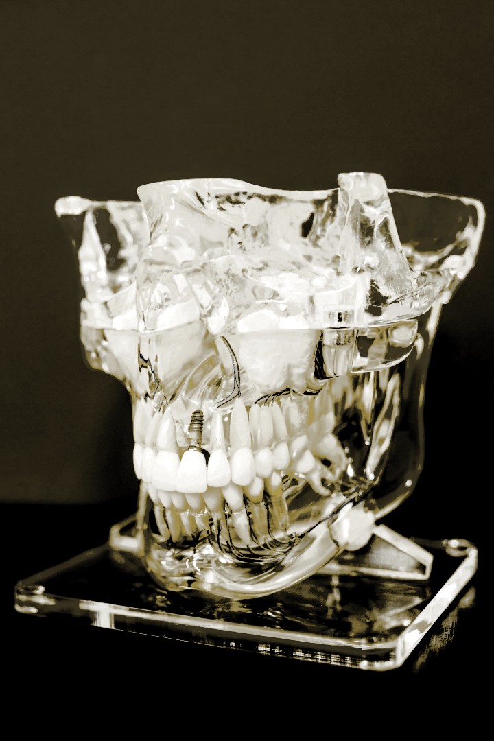 Zahnmedizin belässt tote Strukturen - versteckte Gesundheitsrisiken durch wurzelbehandelte Zähne